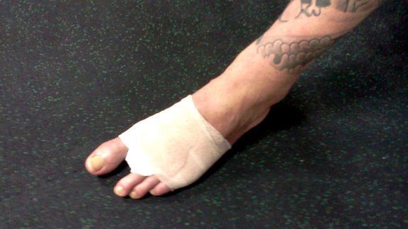 From now on, he'll have to do that training with one less toe.