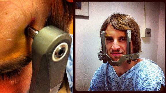 Eastern Bikes pro Josh Perry during radiation therapy earlier today.