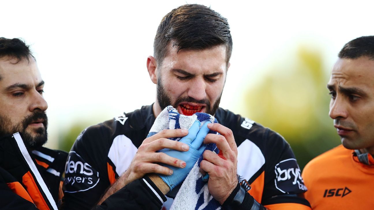 Wests Tigers incensed over Ryan James' charge