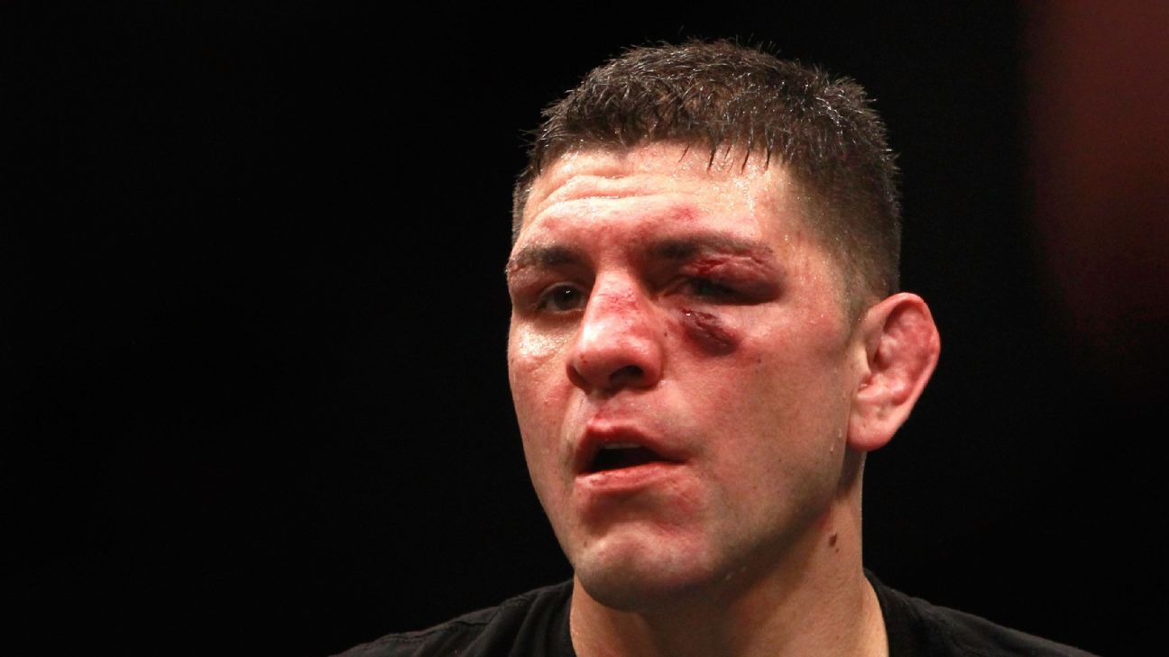 The complicated return of Nick Diaz