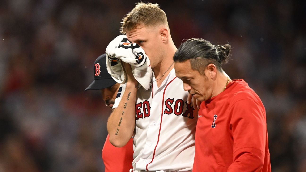 Sox's Houck hit on face by liner in 'scary moment'