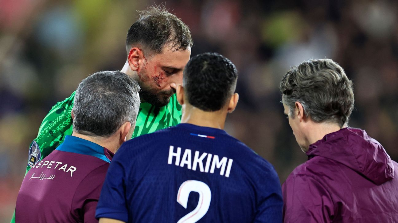 PSG keeper Donnarumma injured by cleat to face