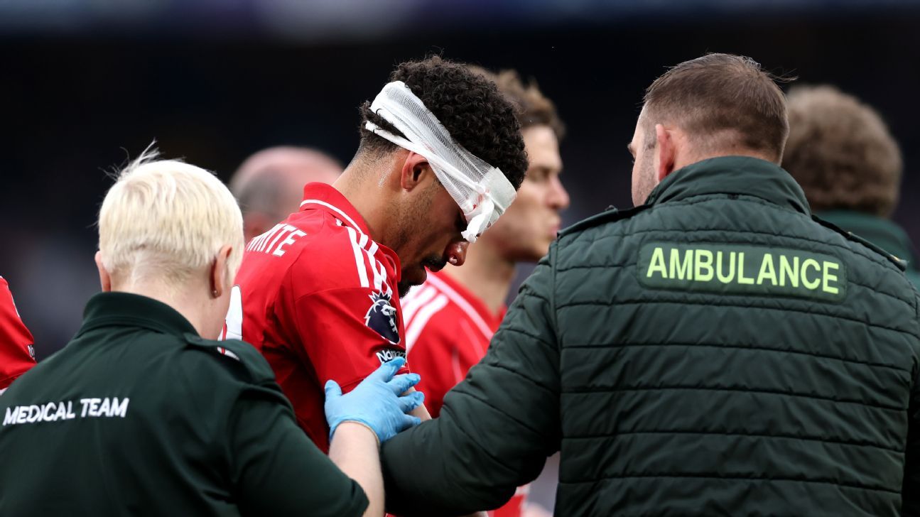 Gibbs-White and Derry Suffer Head Injuries in Forest’s Win at Chelsea