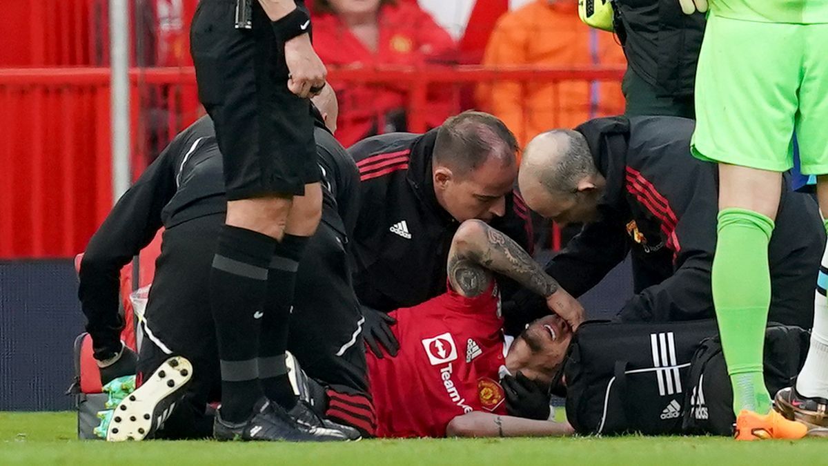 曼联的安东尼在足总杯决赛前受伤