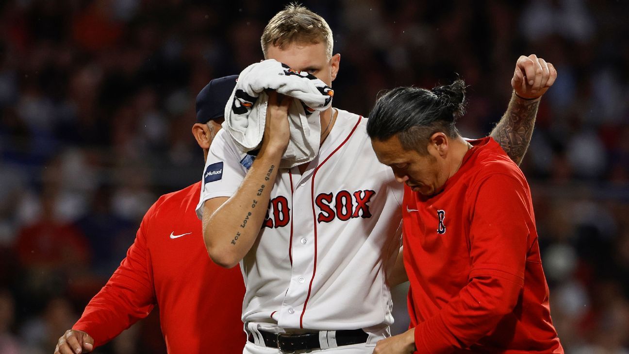 Red Sox say Houck has facial fracture from liner